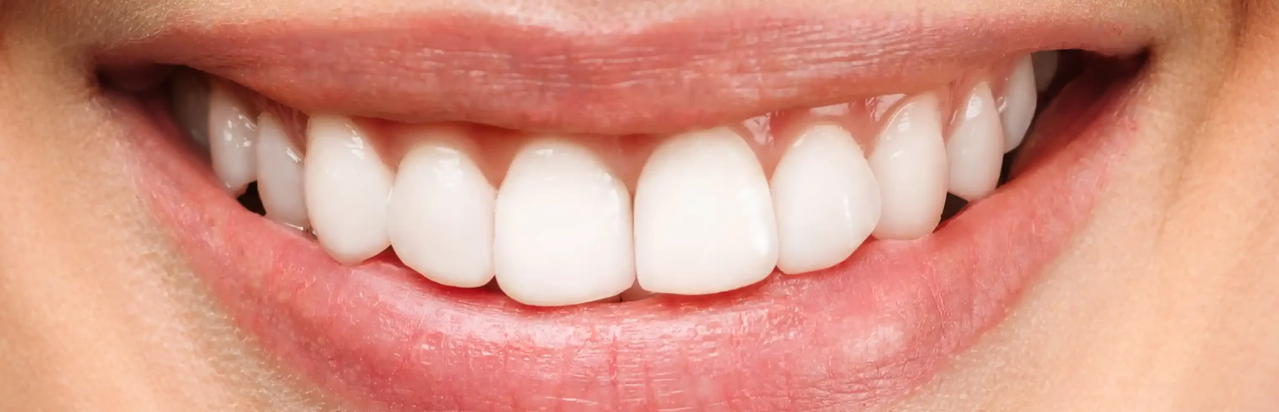 radiant smile after professional teeth whitening treatment