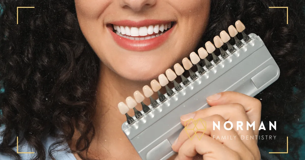 What I Wish I Knew Before Veneers (From a Cosmetic Dentist)